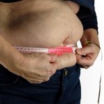 Magenballon Kosten Berlin pricing guide showing expense breakdown for gastric balloon weight loss procedures